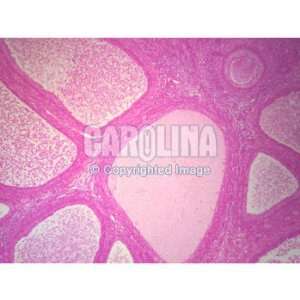 Mammal Ovary Follicles, sec. Microscope Slide, 7 u:  