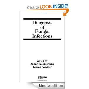 Diagnosis of Fungal Infections (Infectious Disease and Therapy) Johan 